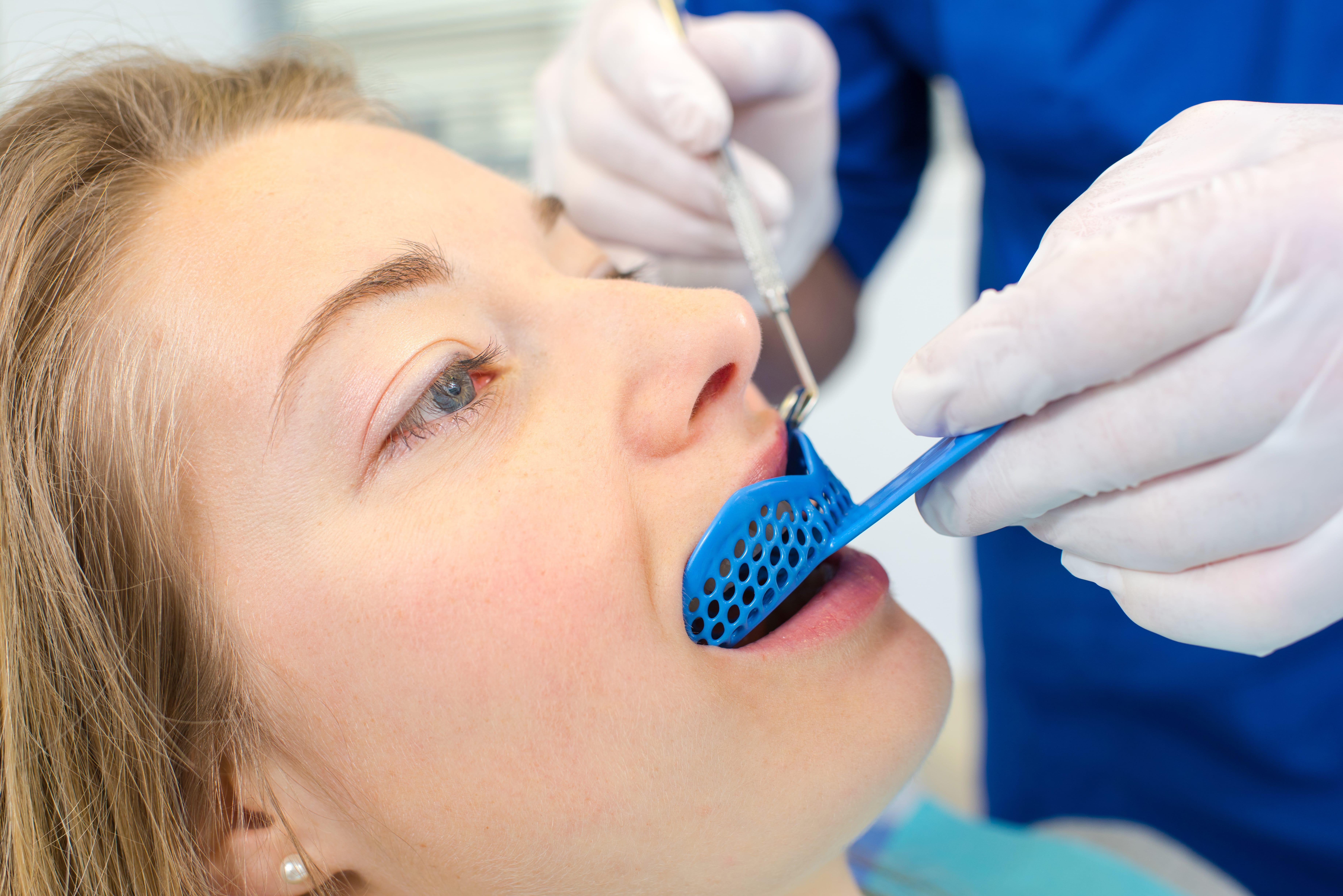Girl getting dental impressions taken of her teeth