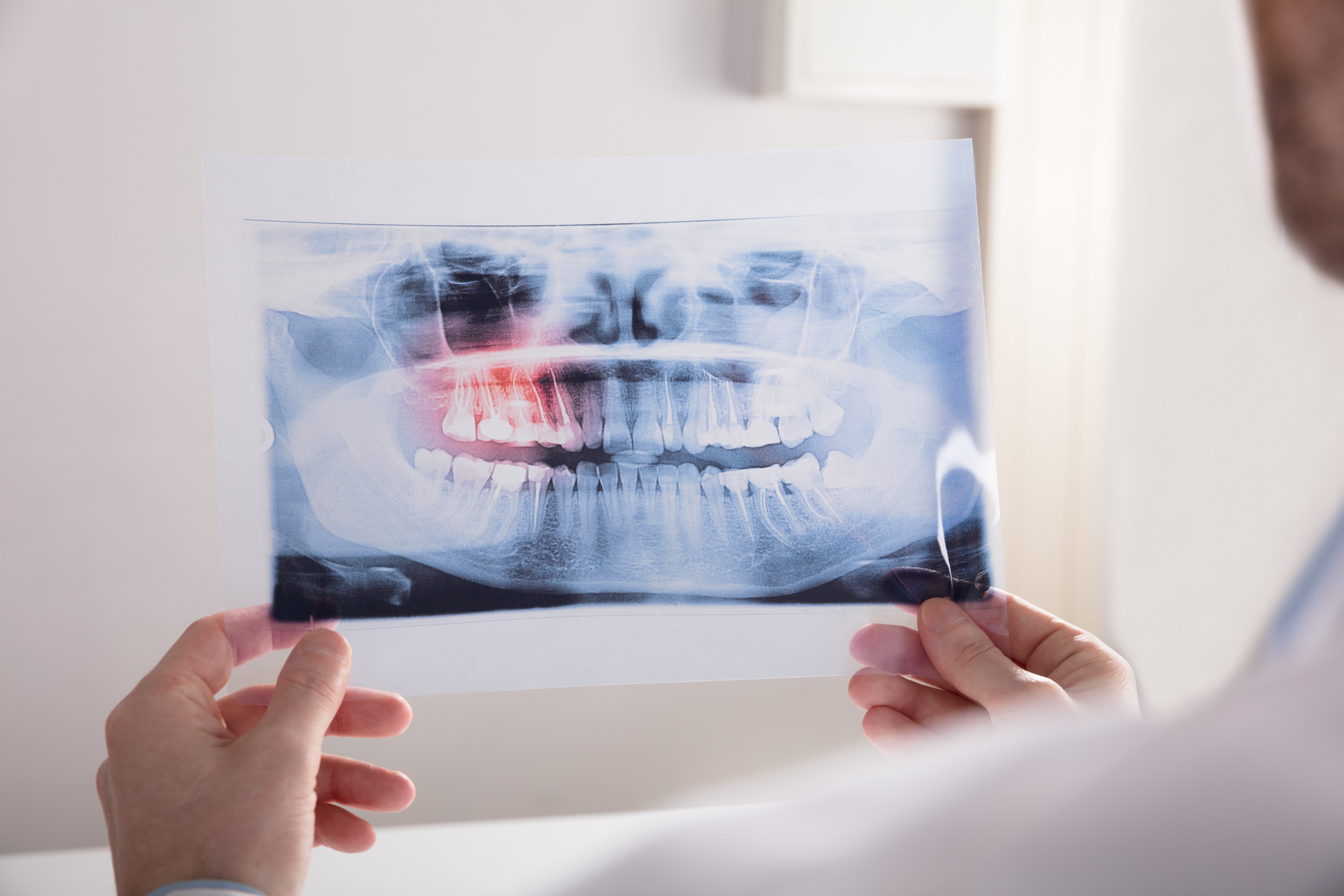 hands holding a dental xray